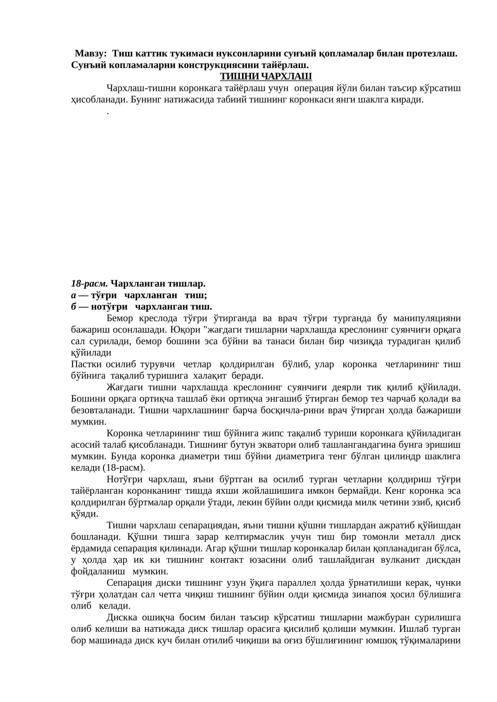 Тиш каттык тукимаси нуксонларини сунъий қопламалар билан протезлаш