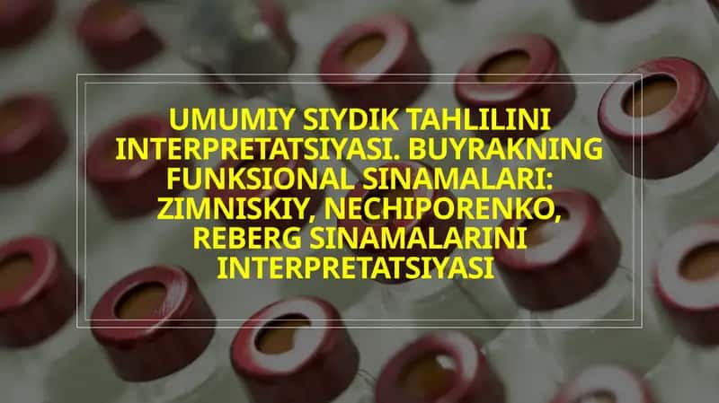 siydik tahlili. zimnitskiy, nechiporenko, reberg sinamalari