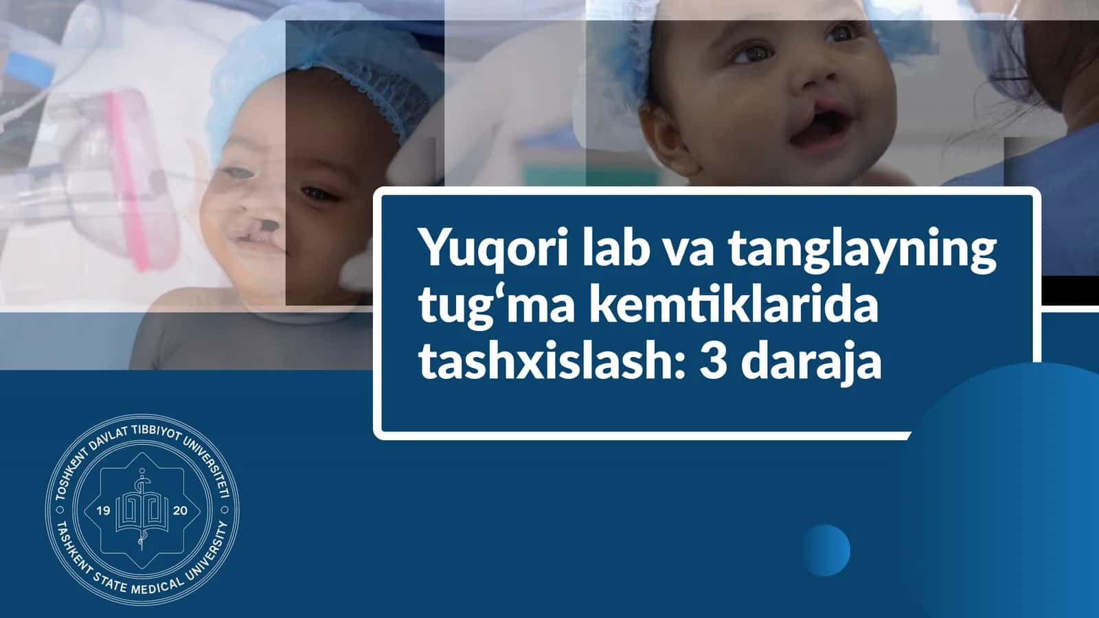 Yuqori labva tanglayning tug‘ma kemtiklarida tashxislash