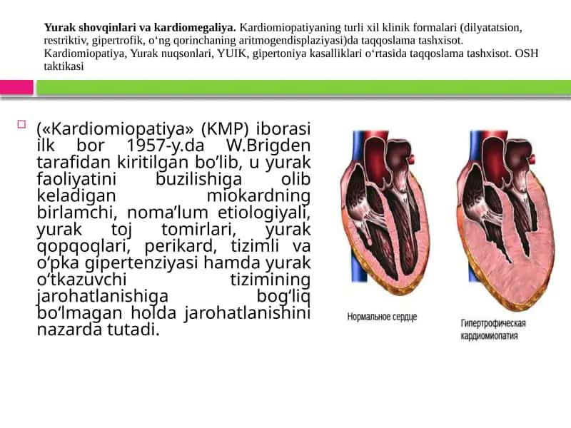 Yurak shovqinlari va kardiomegaliya. Kardiomiopatiyaning turli xil klinik formalari (dilyatatsion, restriktiv, gipertrofik, o‘ng qorinchaning aritmogendisplaziyasi)da taqqoslama tashxisot. Kardiomiopatiya, Yurak nuqsonlari, YUIK, gipertoniya kasalliklari o‘rtasida taqqoslama tashxisot. OSH taktikasi