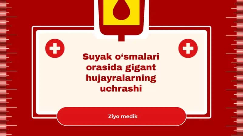 Suyak o‘smalari orasida gigant hujayralarning uchrashi