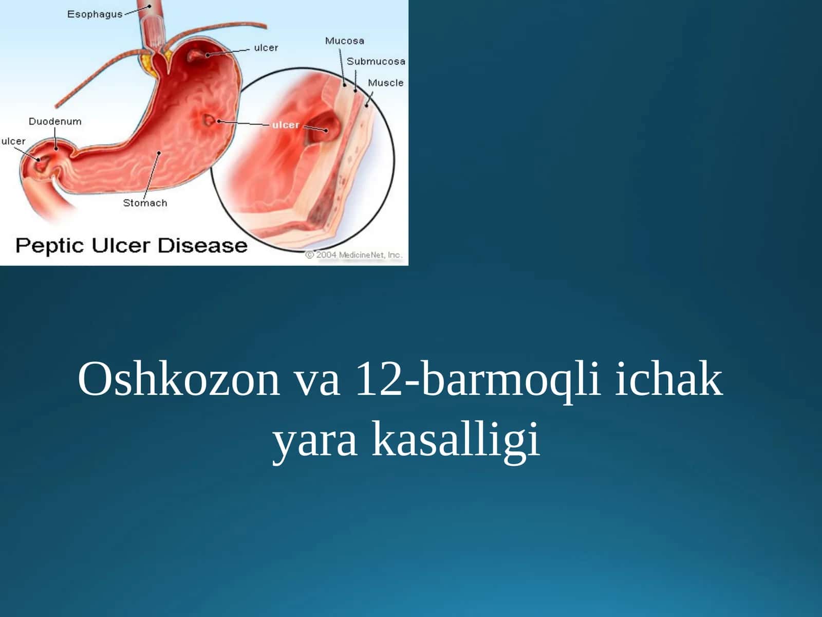 Oshkozonva12-barmoqliichak