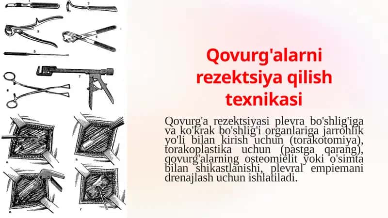 Qovurg'alar rezektsiya qilish texnikasi