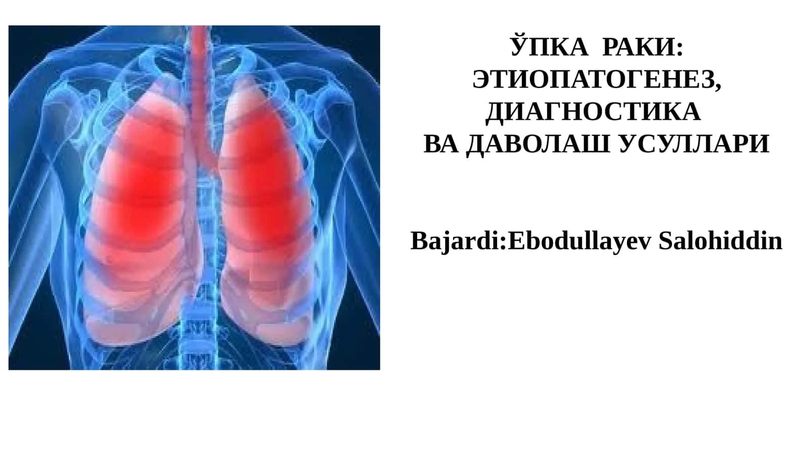ЎПКА РАКИ: ЭТИОПАТОГЕНЕЗ, ДИАГНОСТИКА ВА ДАВОЛАШ УСУЛЛАРИ