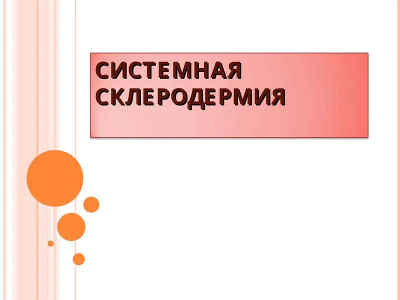 Cистемная склеродермия