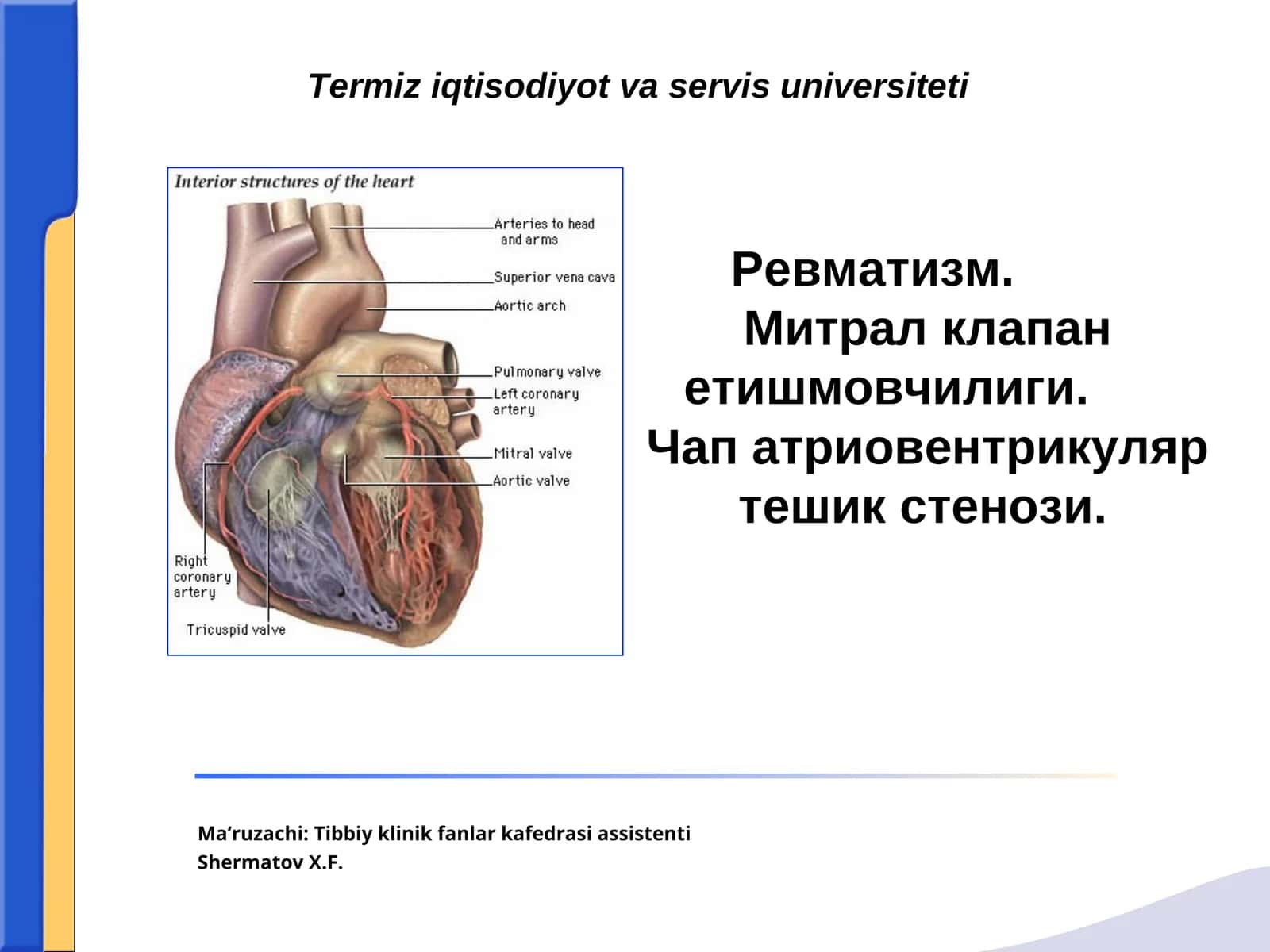 Ревматизм (Сокольский-Буйо касаллиги)