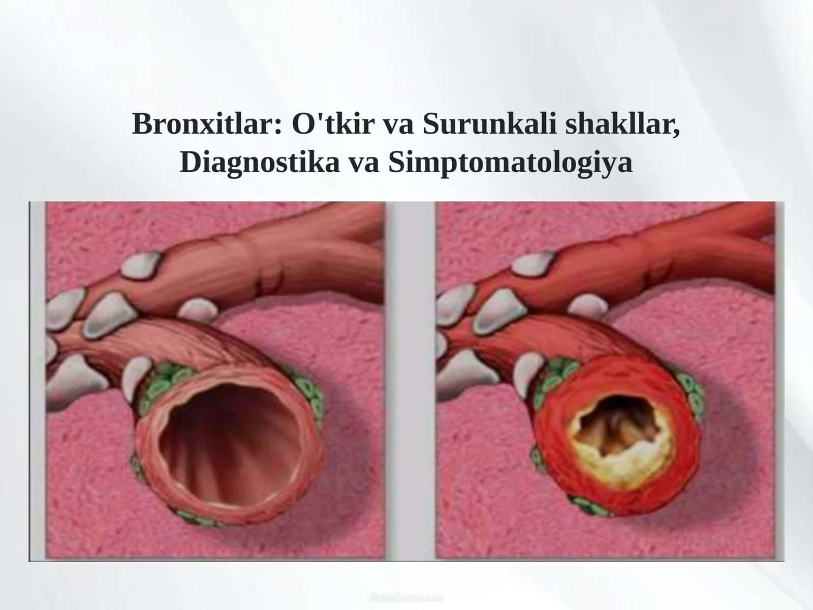 Bronxitlar: O'tkir va Surunkali shakllar, Diagnostika va Simptomatologiya