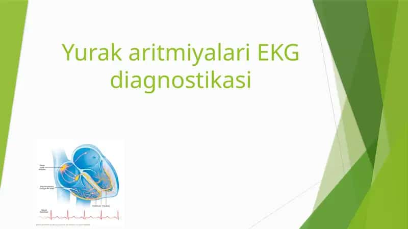 YurakaritmiyalariEKG diagnostikasi