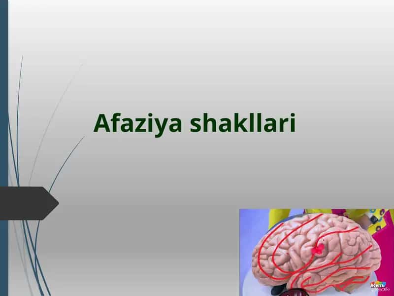 Аfaziyashakllari