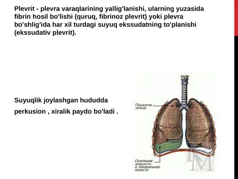 Plevritning tasnifi