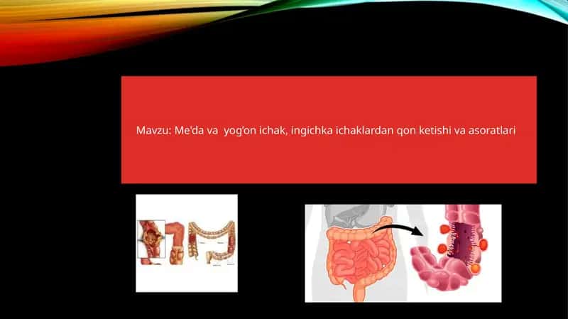Me'da yog‘on ichak, ingichka ichaklardan qon ketishi va asoratlari