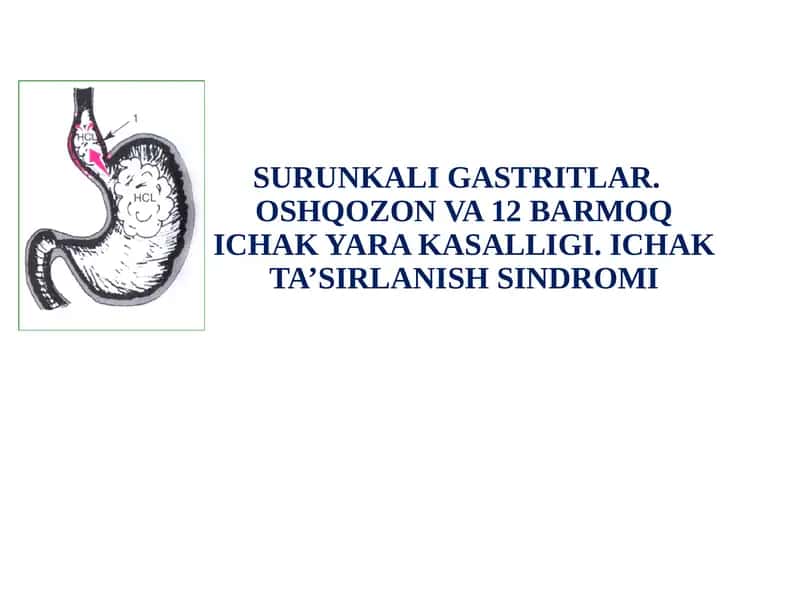 SURUNKALI GASTRITLAR