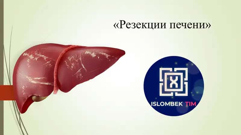 Резекции печени