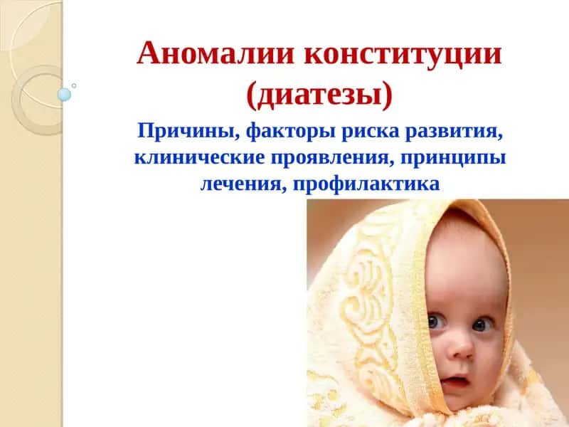 Аномалии конституции (диатезы)