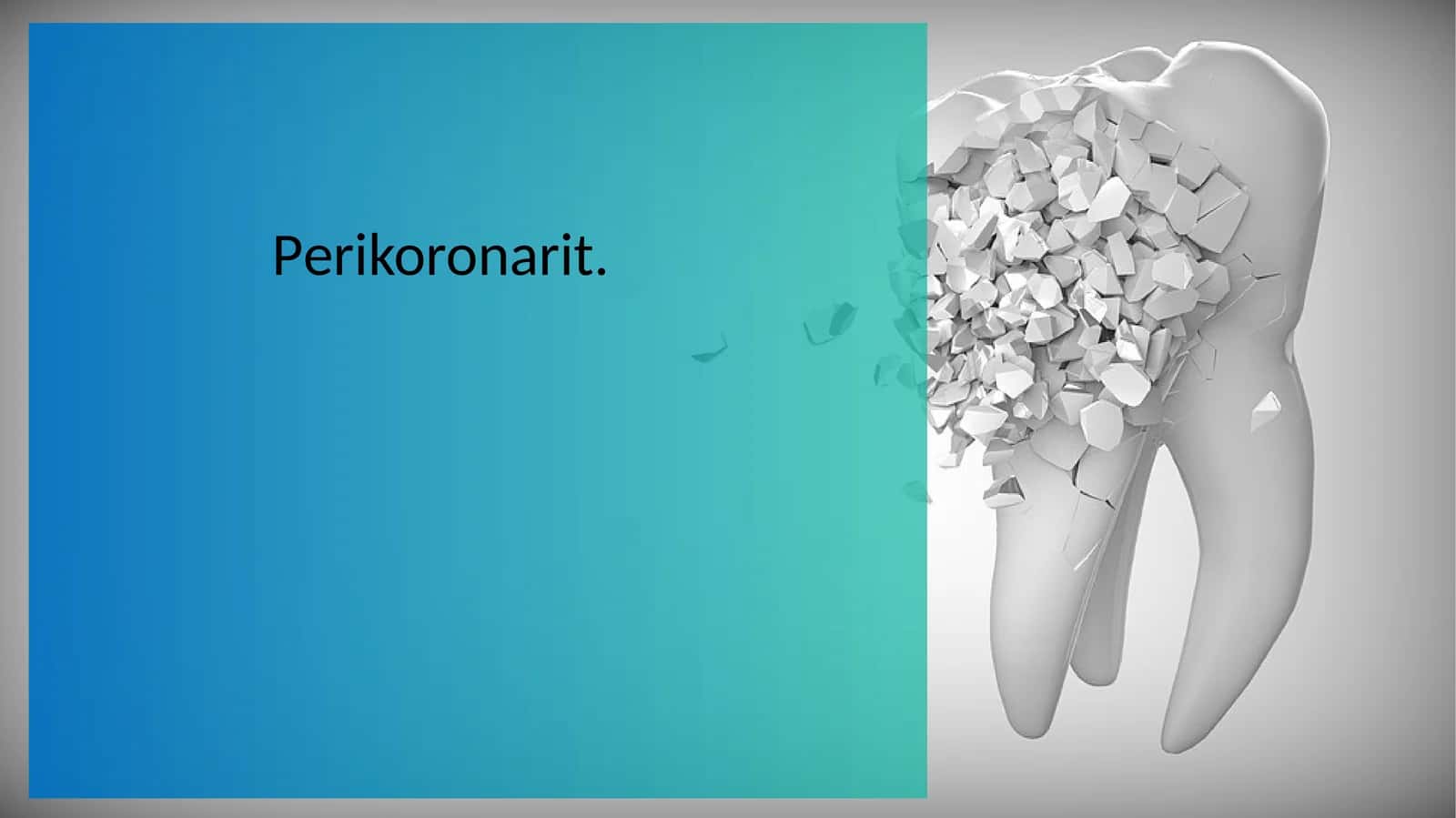 Perikoronarit