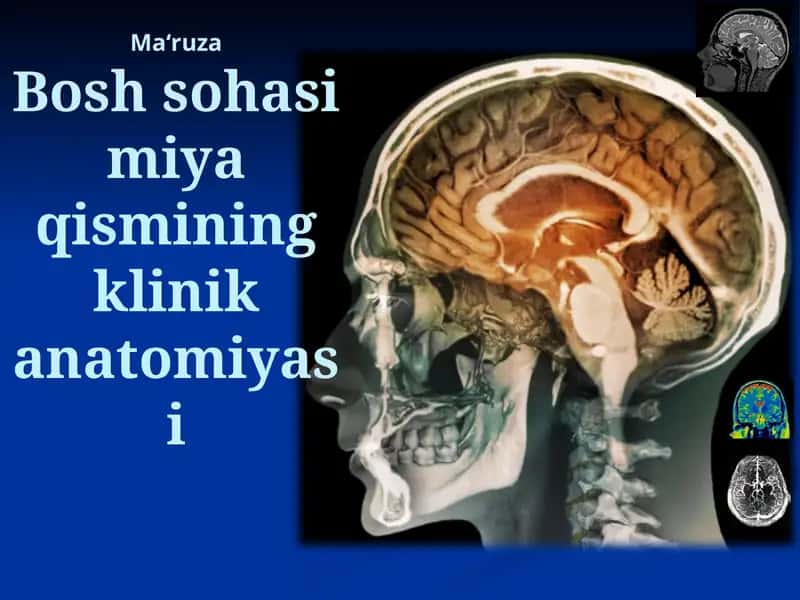 Bosh sohasi miya qismining klinik anatomiyasi