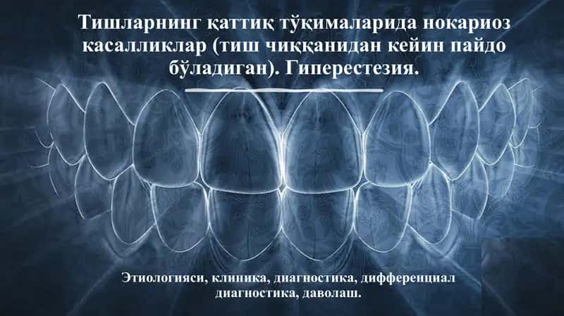 Giperesteziya