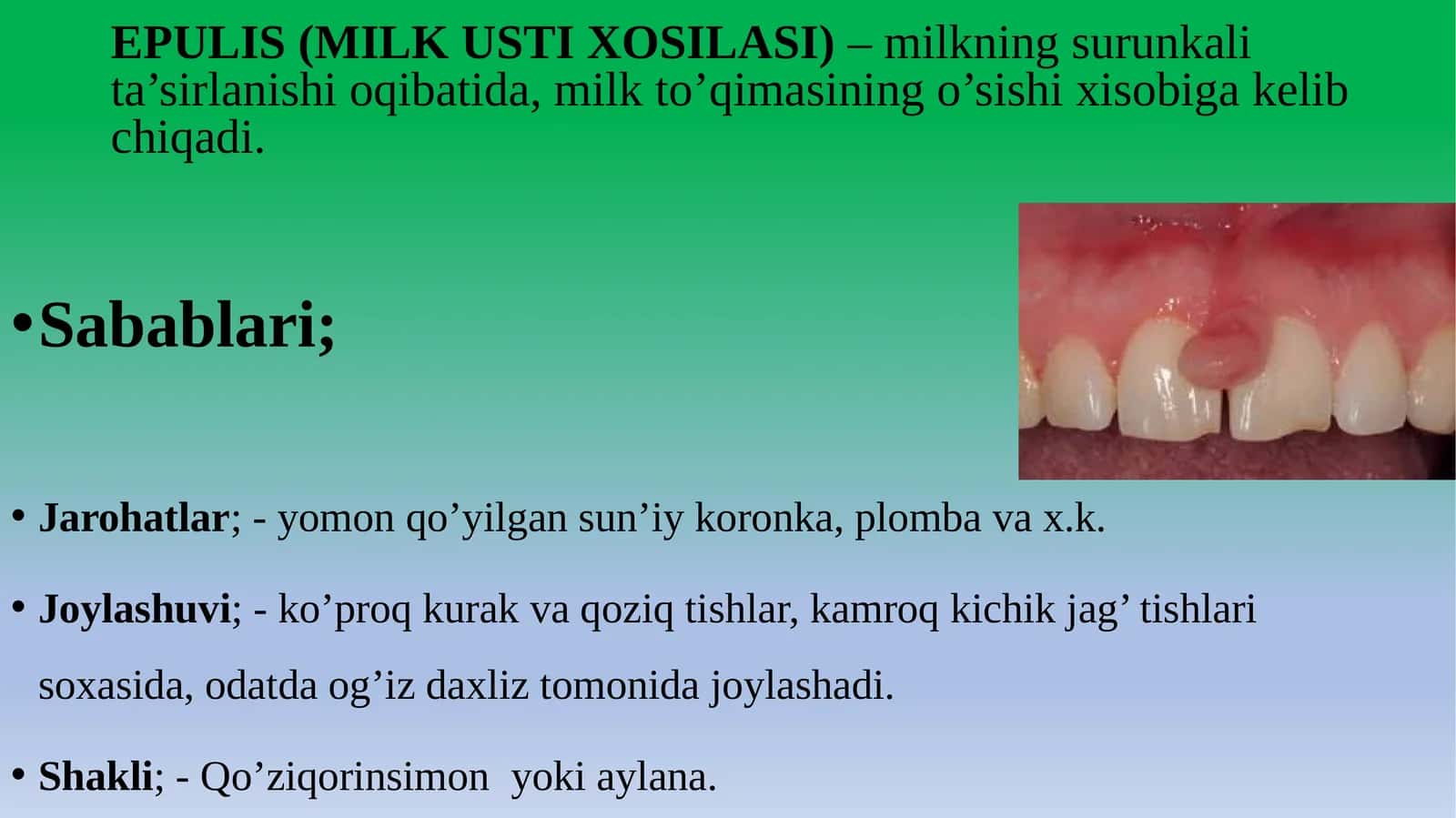 EPULIS (MILK USTI XOSILASI)