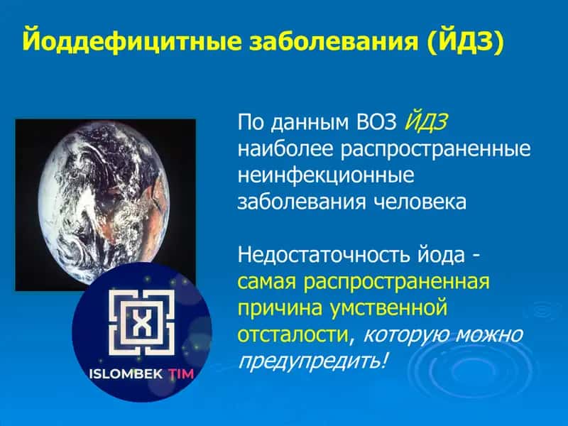 Йод дефицитные заболевания (ЙДЗ)