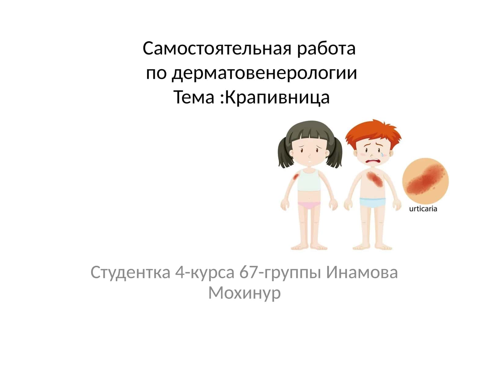 Крапивница