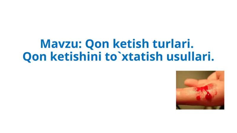 Qon ketish turlari. Qon ketishini to`xtatish usullari.