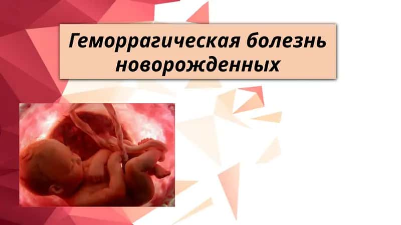 Геморрагическая болезнь новорожденных