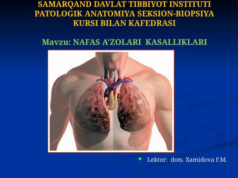 Nafas a'zolari kasaliklari