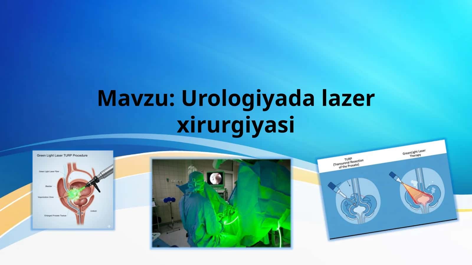 Urologiyada lazer xirurgiyasi