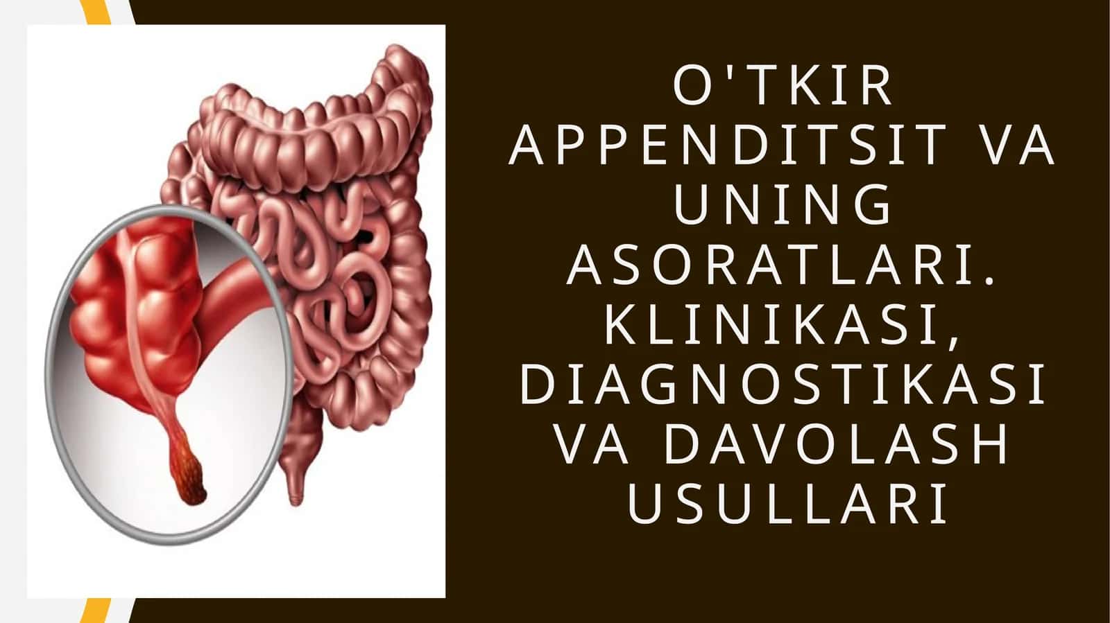 O'tkir appenditsit va uning asoratlari. Klinikasi, diagnostikasi va davolash usullari