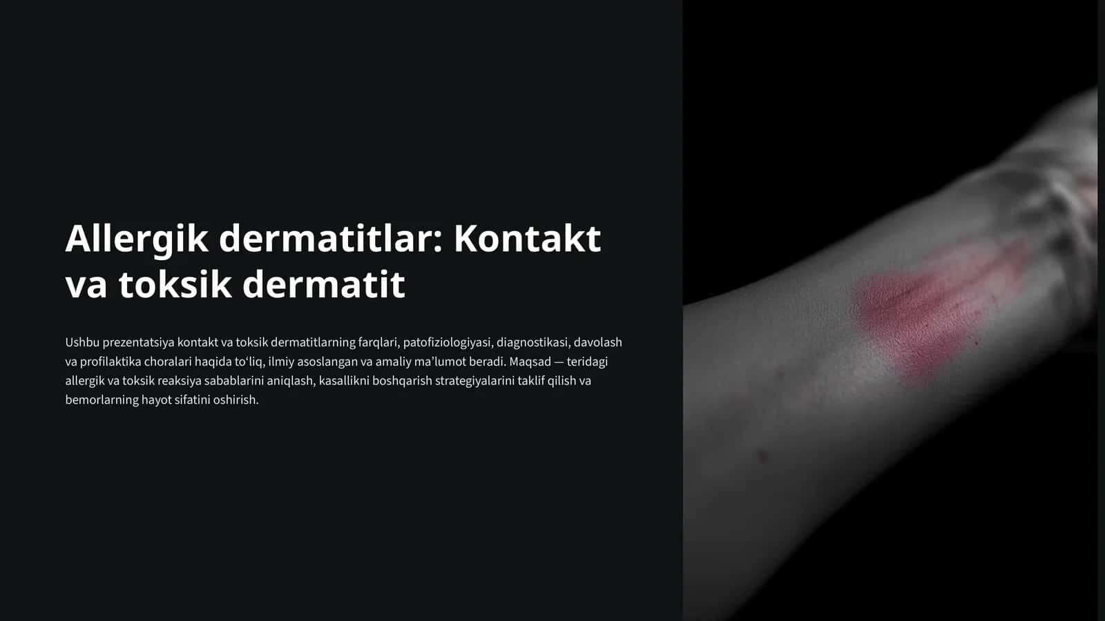 Allergik dermatitlar: Kontakt va toksik dermatit