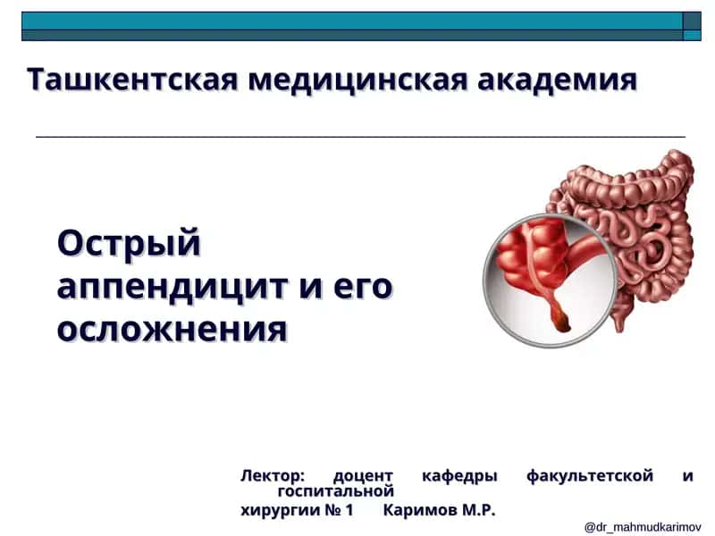 Острый аппендицит и его осложнения