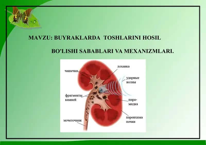 BUYRAKLARDATOSHLARINI HOSIL BO'LISHI SABABLARI VA MEXANIZMLARI
