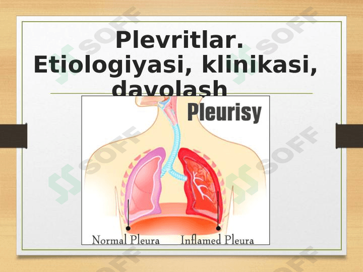 Plevritlar. Etiologiyasi, klinikasi, davolash usullari