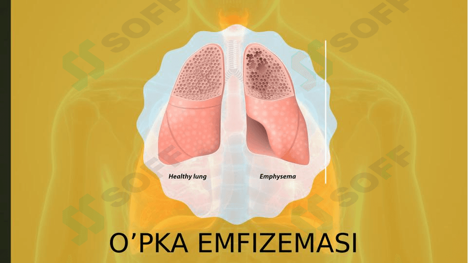 O'PKA EMFIZEMASI