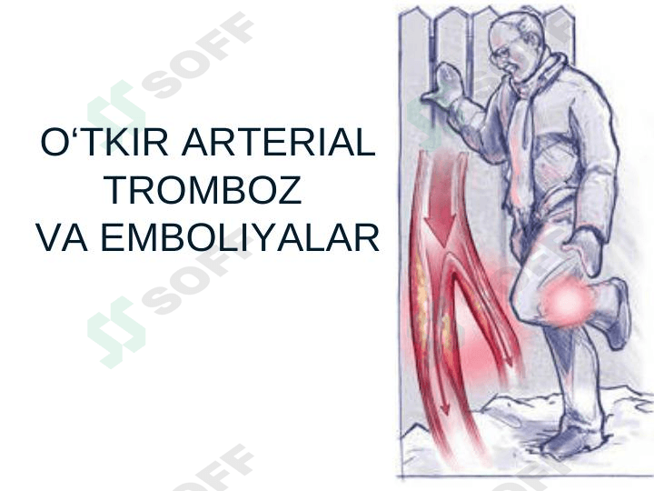O‘TKIR ARTERIAL,TROMBOZ VA EMBOLIYALAR