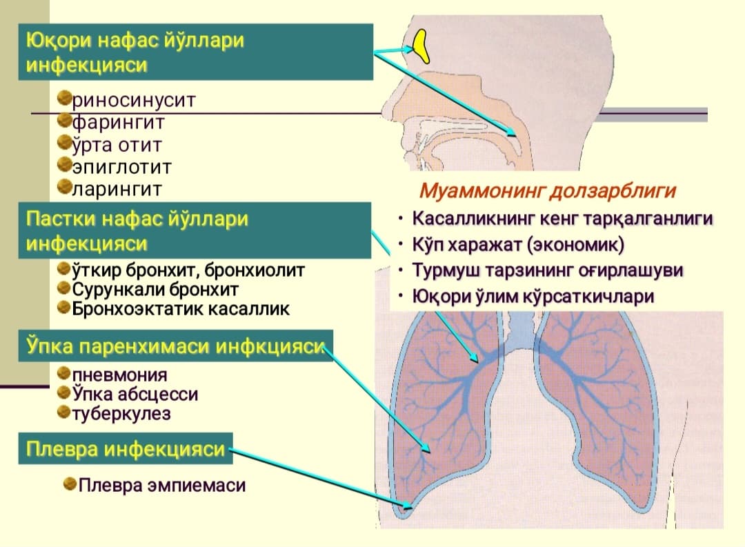 Болаларда Пневмония, этиопатогенези,клиникаси,диагностикаси ва даволаш