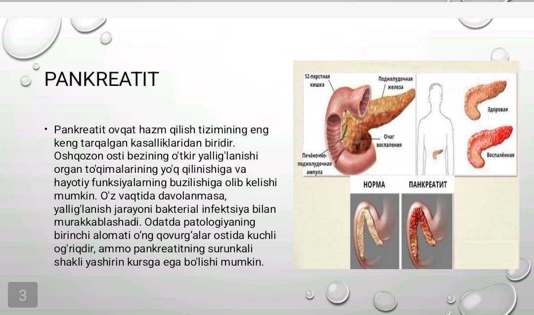 Pankreatit rivojlanishining biokimyoviy asoslari davolash va diagnostika tamoyillari, ingichka ichakda parchalanish mahsulotlari so’rilishining buzilishi(seliakiya), kron kasalligi va yarali kolit rivojlanishining biokimyoviy asoslari.