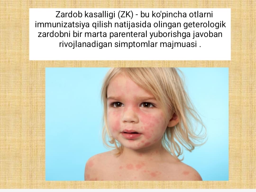 Zardob kasalligi