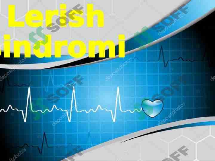 Lerish sindromi