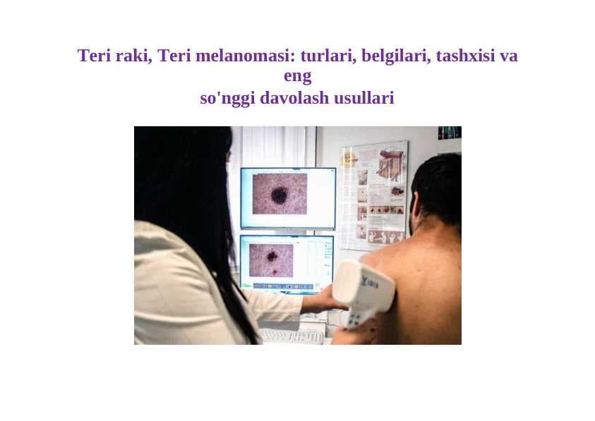 Teri raki, Teri melanomasi: turlari, belgilari, tashxisi va eng so'nggi davolash usullari