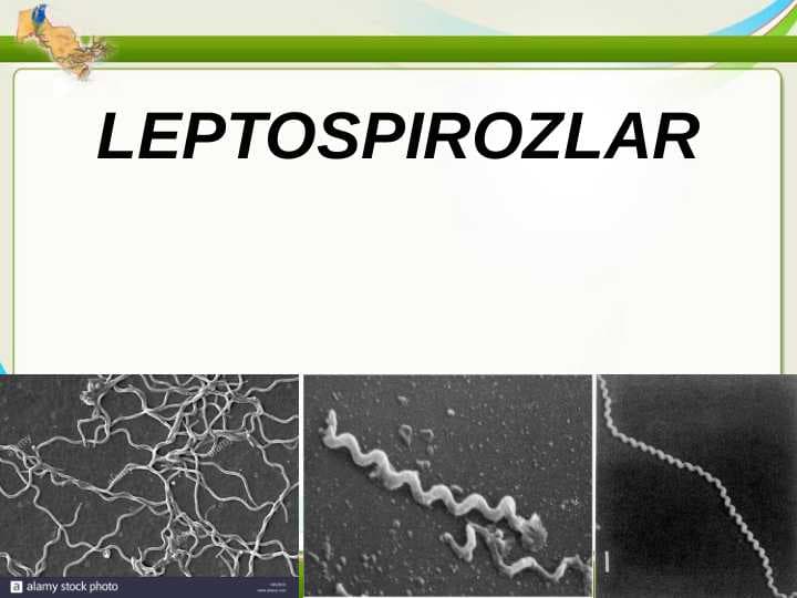 LEPTOSPIROZLAR. GEMORRAGIK ISITMA QO'ZG'ATUVCHILARI, PATOGENEZI, LABORATORIYA TASHHISI. LEPTOSPIROZLAR MORFOLOGIYASI, STRUKTURASI, TARQALGANLIGI, KELTIRIB CHIQARUVCHI KASALLIKLARI VA LABORATORIYA TASHHISI.