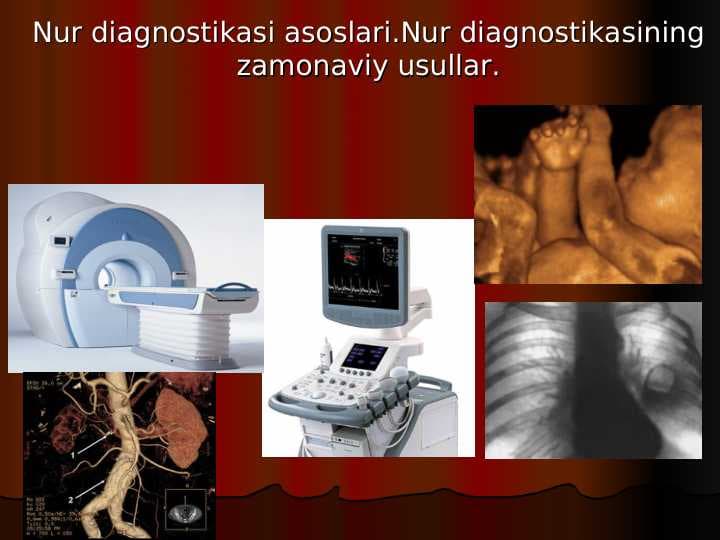 Nur diagnostikasi asoslari.Nur diagnostikasining zamonaviy usullari.