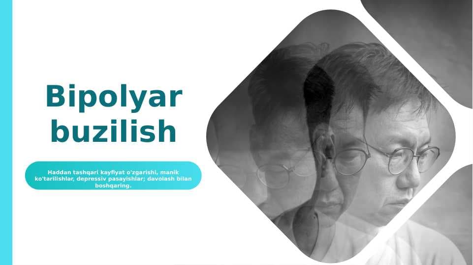 Bipolyar buzilish