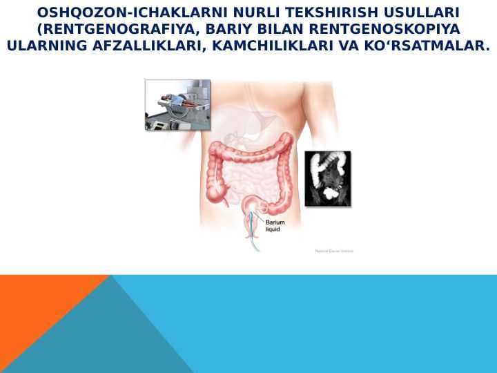Oshqozon-ichaklarni nurli tekshirish usullari (rentgenografiya, bariy bilan rentgenoskopiya ularning afzalliklari, kamchiliklari va ko‘rsatmalar.