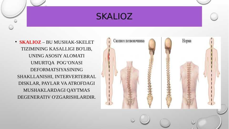 SKALIOZ