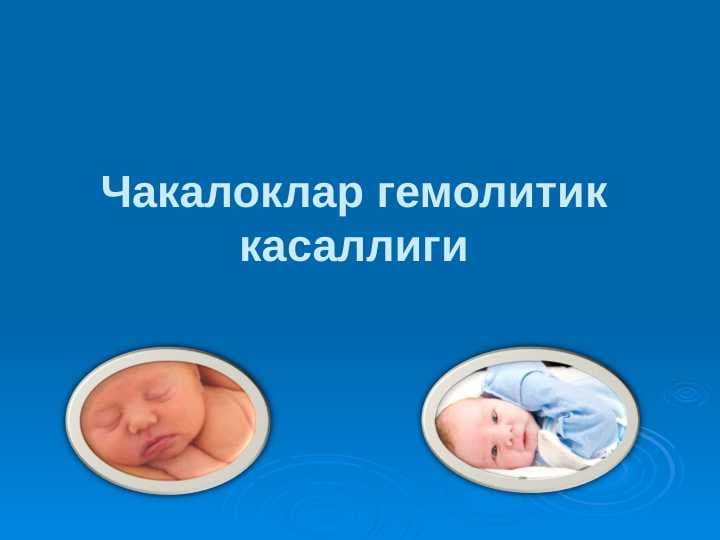 Chaqaloqlar gemolitik kasalligi . Чакалоклар гемолитик касаллиги