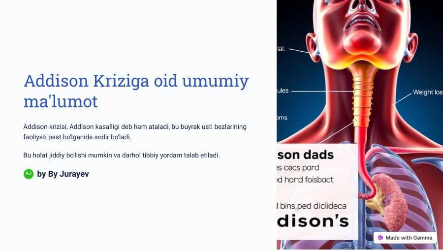 Addison Kriziga oid umumiy ma'lumot