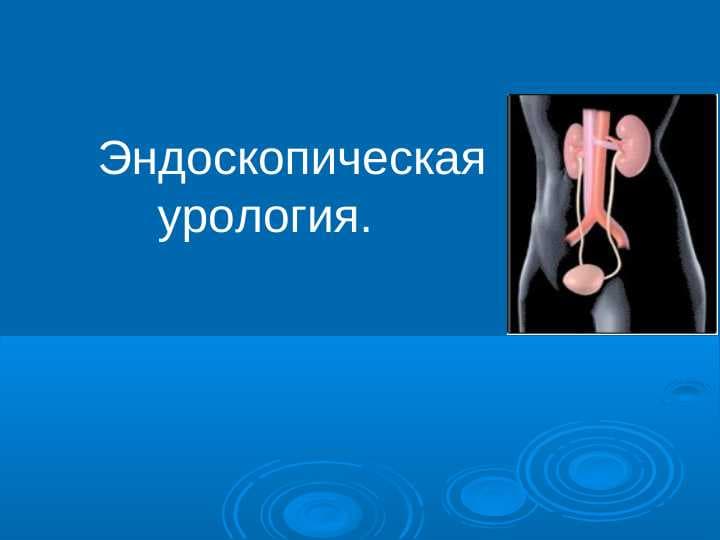 Эндоскопическая урология.