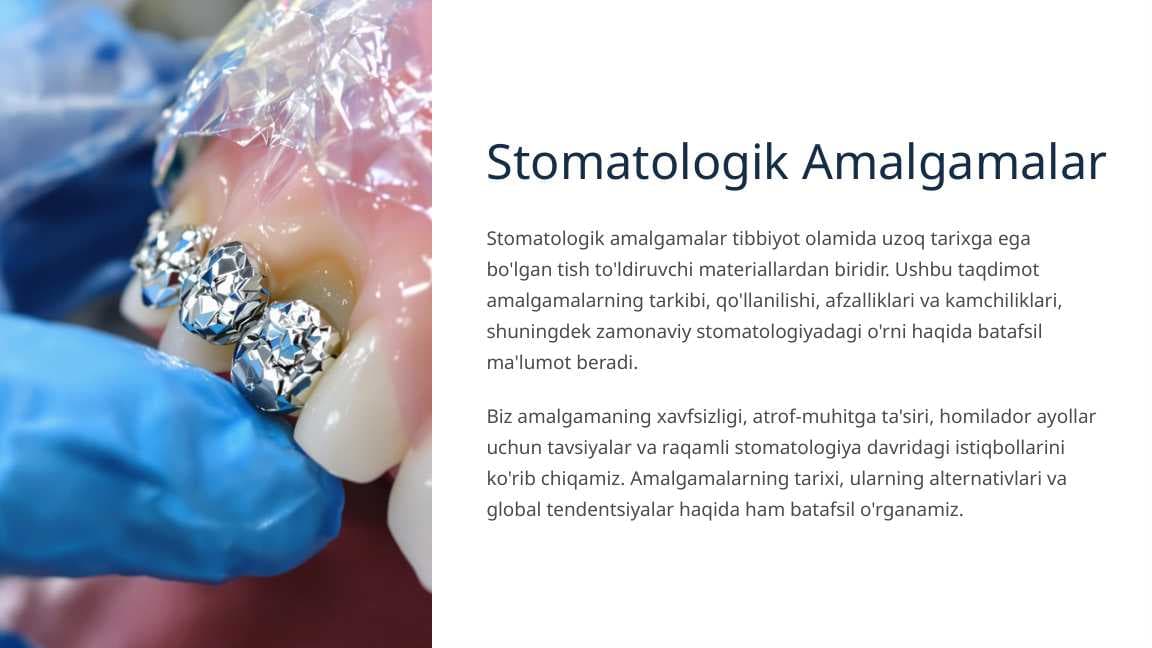 Amalgamalar.