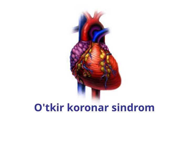 O'tkir koronar sindrom